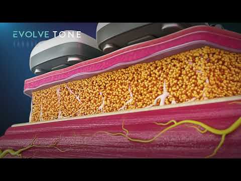 EvolveX TONE: Strengthening and Toning Muscle - 60 Minutes